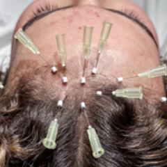 PDRN DE SALMON CAPILAR O FACIAL